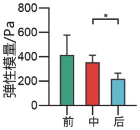 一种肠道体外低温保存方法及应用